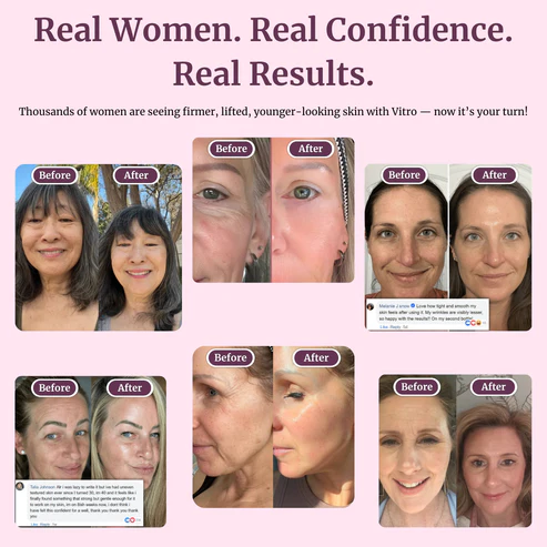 Transform Wrinkles, Fine Lines, And Tired Creases Naturally