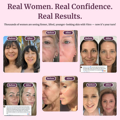 Transform Wrinkles, Fine Lines, And Tired Creases Naturally