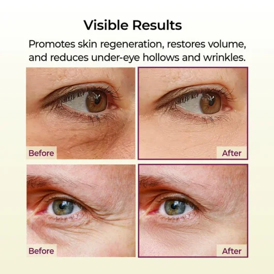 Transform Wrinkles, Fine Lines, And Tired Creases Naturally