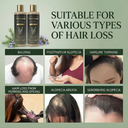 Growth-Support Shampoo - 2-Pack