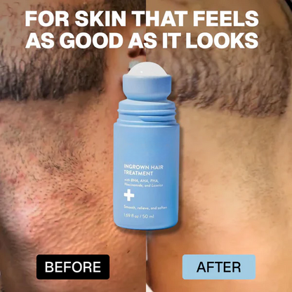 Viralaluna: Smoothing Solution For Ingrown Hairs