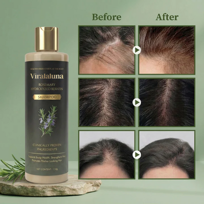 Growth-Support Shampoo - 2-Pack