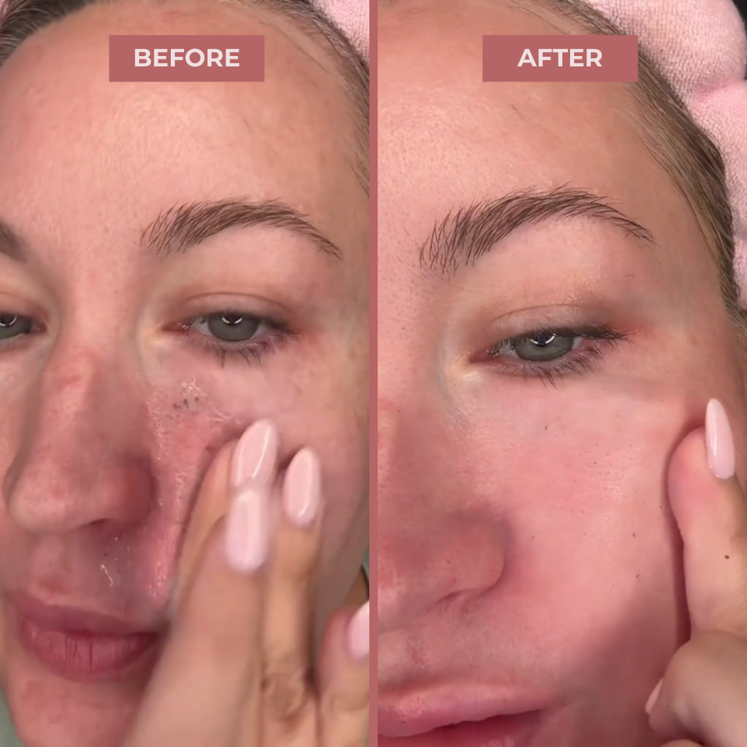 Peel Shot Glow Rice Ampoule Duo