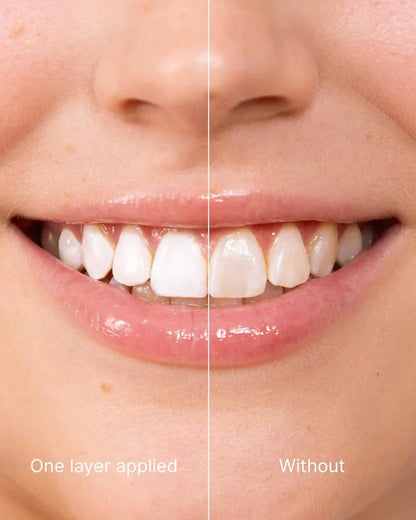 Tooth Polish