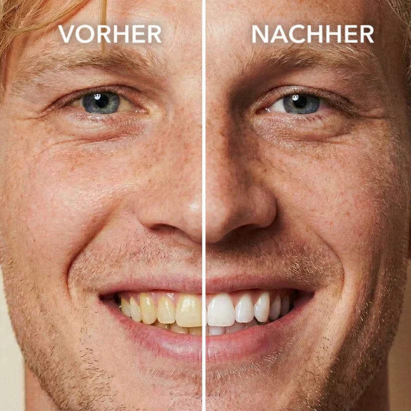 Tooth Polish