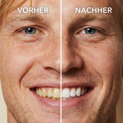 Tooth Polish