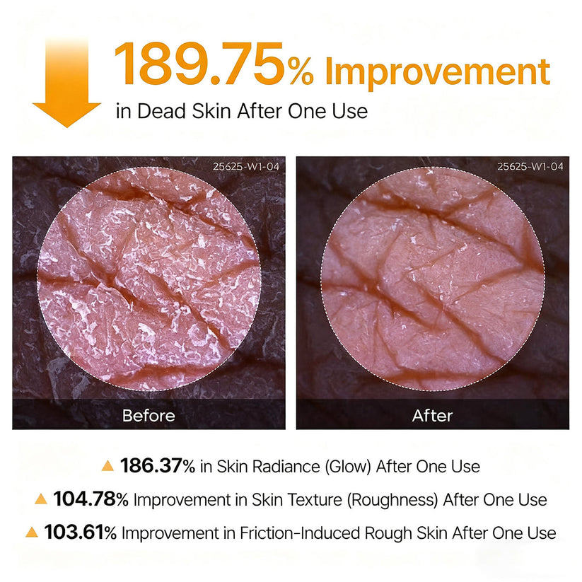 Viralaluna Peel Shot - Kojic + Turmeric Body Peel Spray