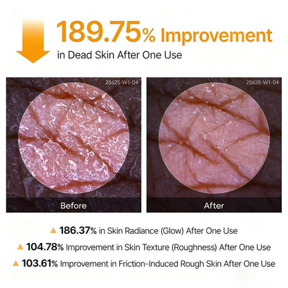 Viralaluna Peel Shot - Kojic + Turmeric Body Peel Spray
