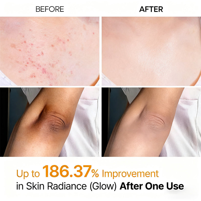Viralaluna Peel Shot - Kojic + Turmeric Body Peel Spray