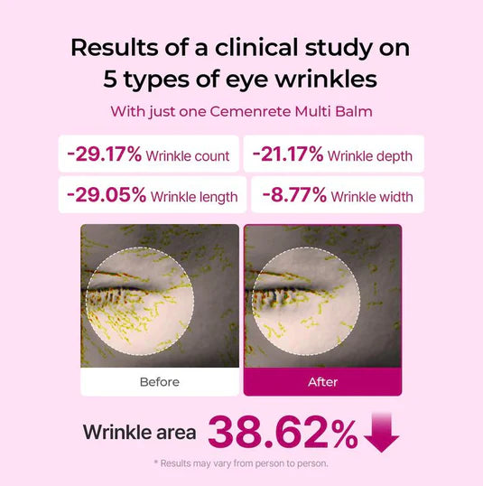 Transform Wrinkles, Fine Lines, And Tired Creases Naturally